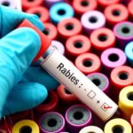 Rabies warnings issued in multiple Charlotte-area counties
